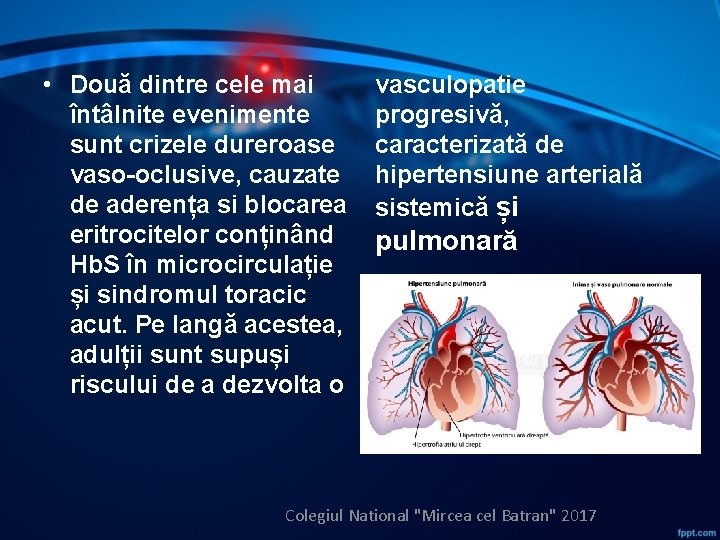  • Două dintre cele mai întâlnite evenimente sunt crizele dureroase vaso-oclusive, cauzate de