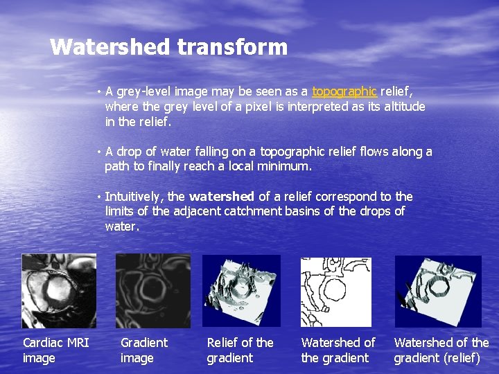 Watershed transform • A grey-level image may be seen as a topographic relief, where