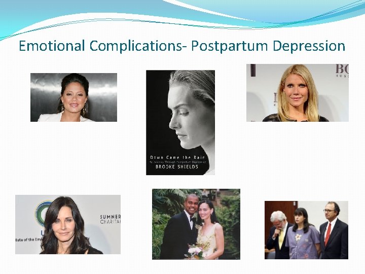 Emotional Complications- Postpartum Depression 