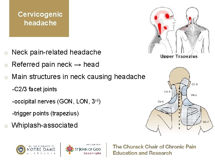 Cervicogenic headache o Neck pain-related headache o Referred pain neck → head o Main