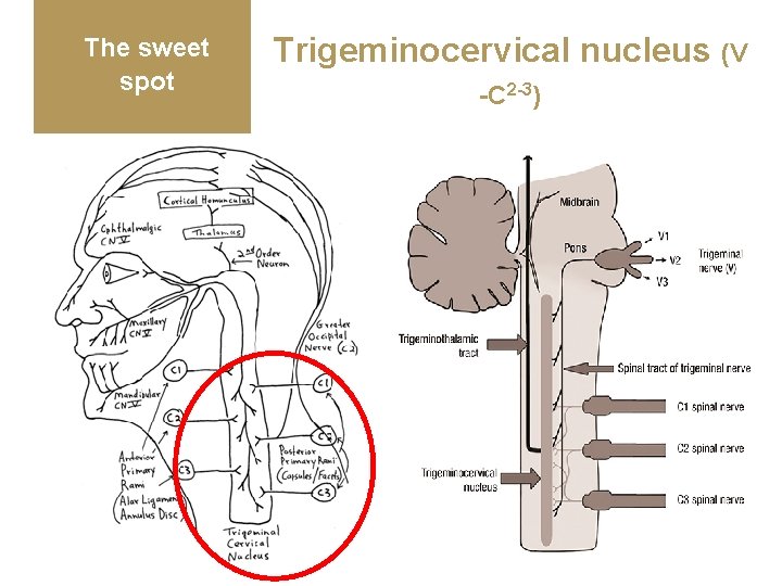 The sweet spot Trigeminocervical nucleus (V -C 2 -3) 