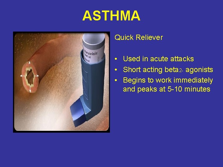 ASTHMA Quick Reliever • Used in acute attacks • Short acting beta 2 -