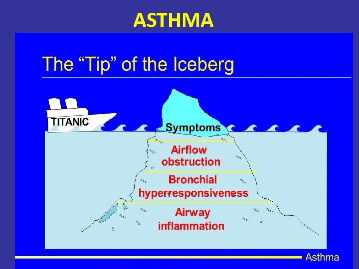 ASTHMA 