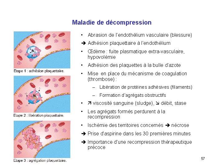 Maladie de décompression • Abrasion de l’endothélium vasculaire (blessure) Adhésion plaquettaire à l’endothélium •