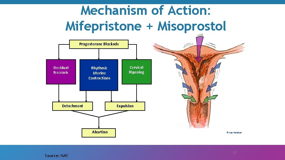 Mechanism of Action: Mifepristone + Misoprostol Progesterone Blockade Decidual Necrosis Rhythmic Uterine Contractions Detachment