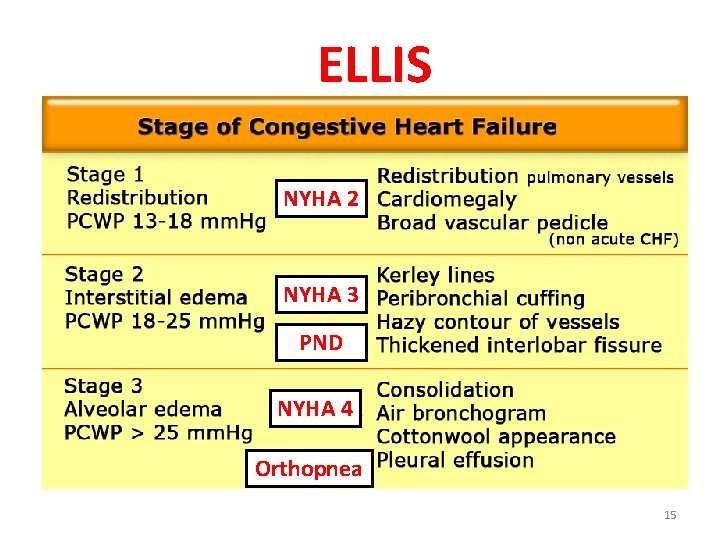 ELLIS NYHA 2 NYHA 3 PND NYHA 4 Orthopnea 15 