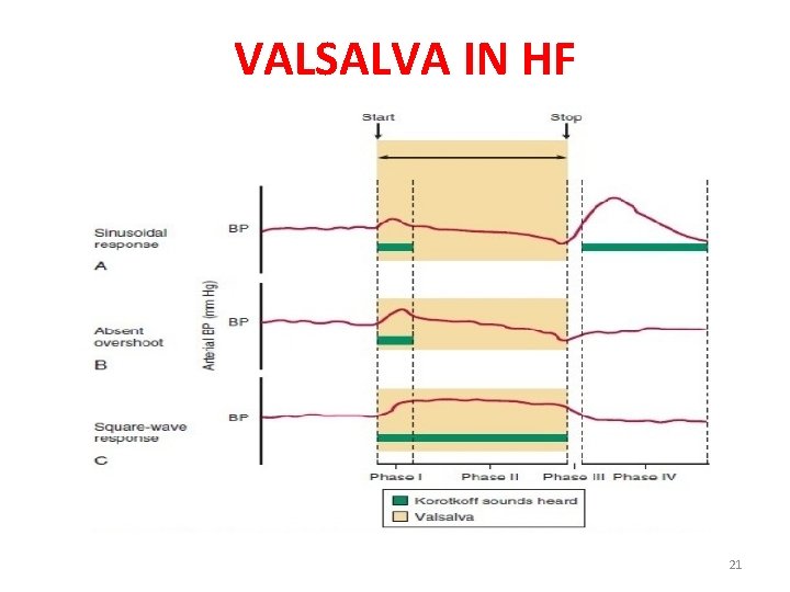 VALSALVA IN HF 21 