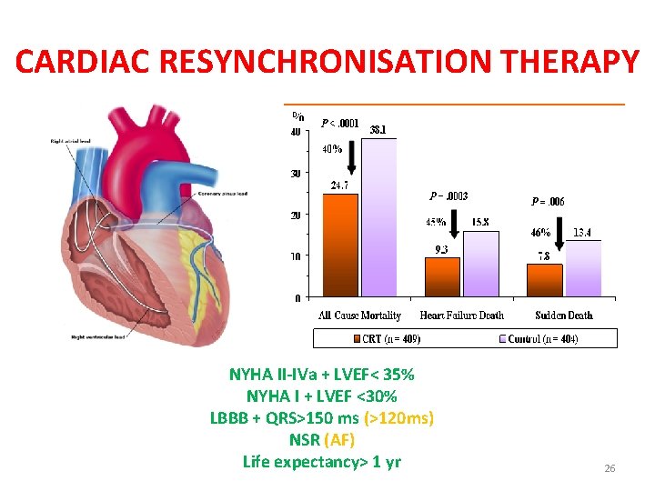 CARDIAC RESYNCHRONISATION THERAPY NYHA II-IVa + LVEF< 35% NYHA I + LVEF <30% LBBB