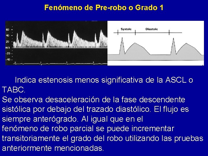 Fenómeno de Pre-robo o Grado 1 Indica estenosis menos significativa de la ASCL o