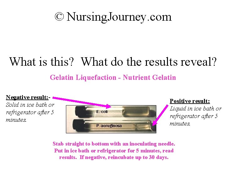 © Nursing. Journey. com What is this? What do the results reveal? Gelatin Liquefaction