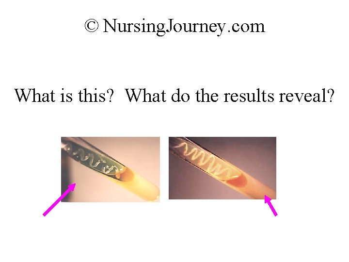 © Nursing. Journey. com What is this? What do the results reveal? 