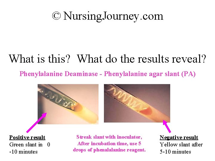 © Nursing. Journey. com What is this? What do the results reveal? Phenylalanine Deaminase