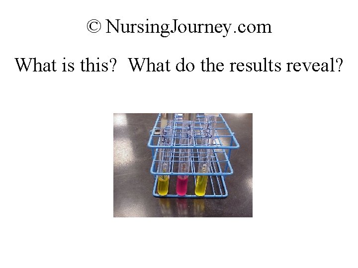 © Nursing. Journey. com What is this? What do the results reveal? 