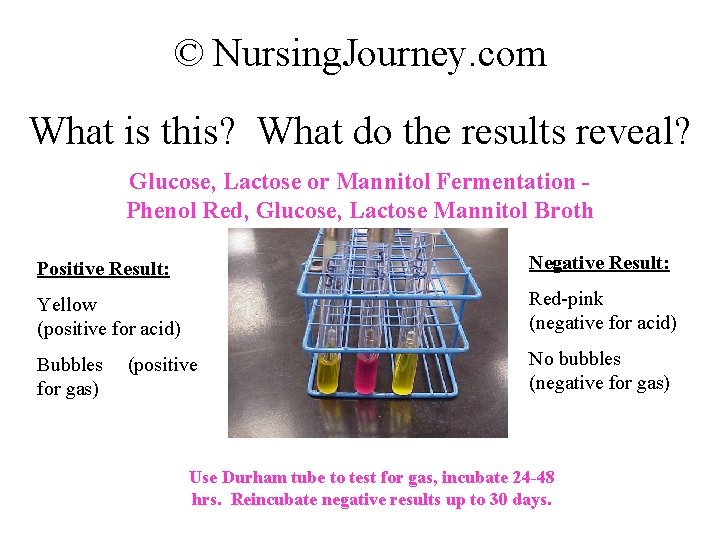 © Nursing. Journey. com What is this? What do the results reveal? Glucose, Lactose