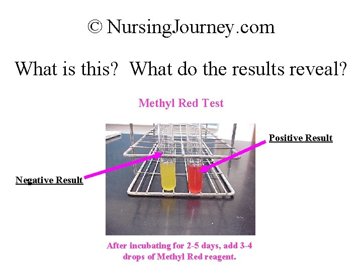 © Nursing. Journey. com What is this? What do the results reveal? Methyl Red