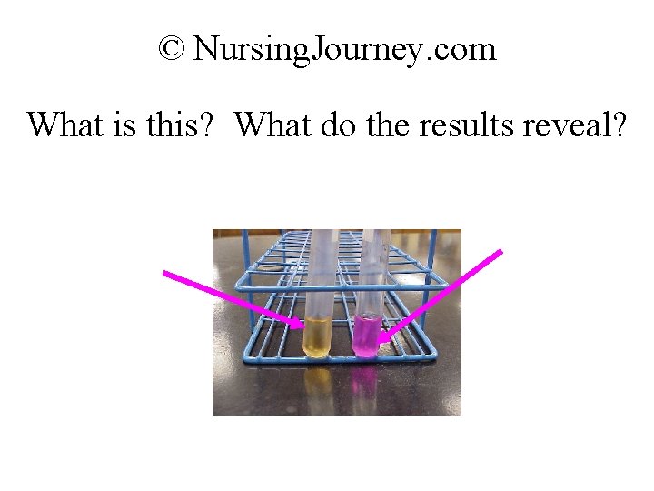 © Nursing. Journey. com What is this? What do the results reveal? 