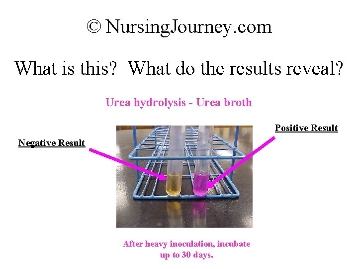© Nursing. Journey. com What is this? What do the results reveal? Urea hydrolysis