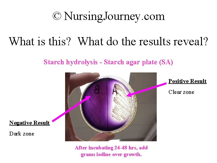 © Nursing. Journey. com What is this? What do the results reveal? Starch hydrolysis