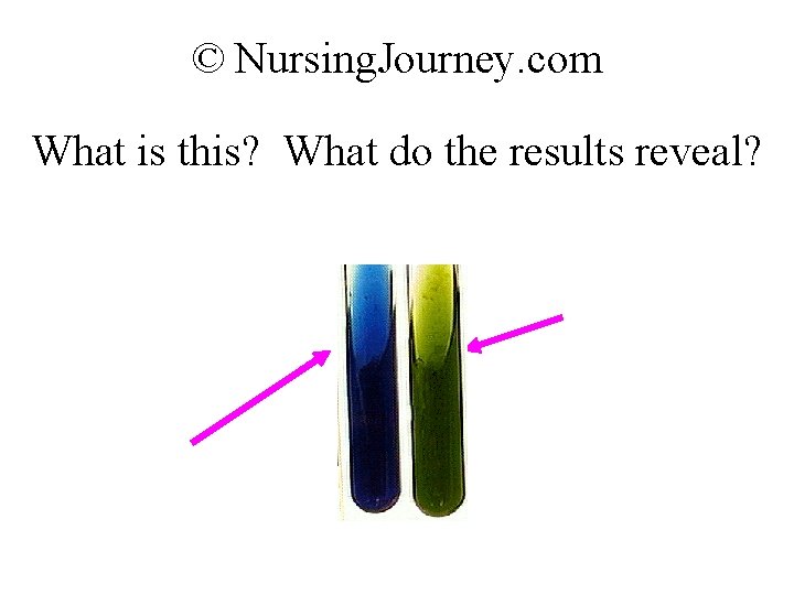 © Nursing. Journey. com What is this? What do the results reveal? 