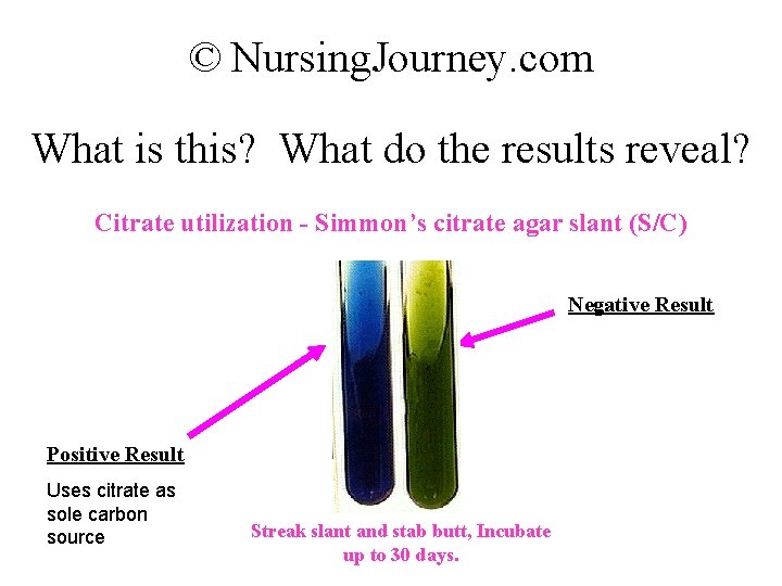 © Nursing. Journey. com What is this? What do the results reveal? Citrate utilization