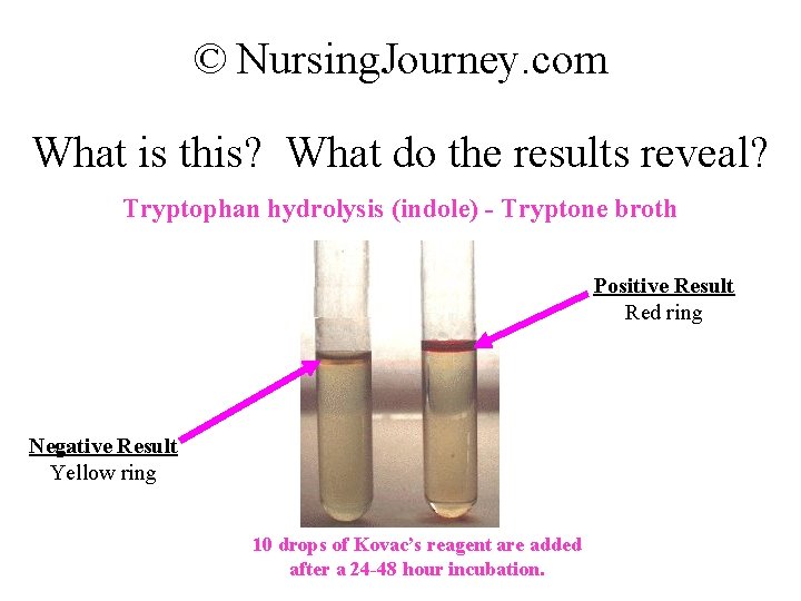 © Nursing. Journey. com What is this? What do the results reveal? Tryptophan hydrolysis