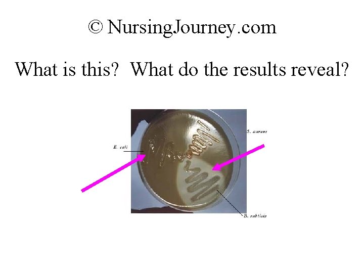 © Nursing. Journey. com What is this? What do the results reveal? 