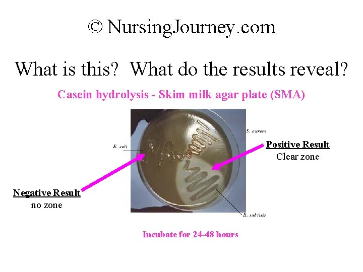 © Nursing. Journey. com What is this? What do the results reveal? Casein hydrolysis