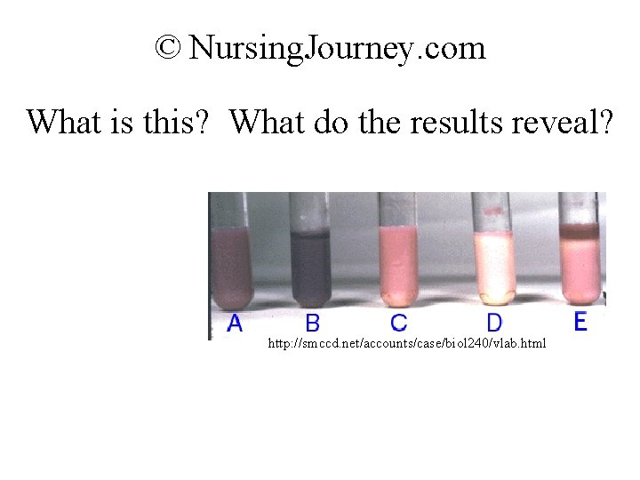 © Nursing. Journey. com What is this? What do the results reveal? http: //smccd.