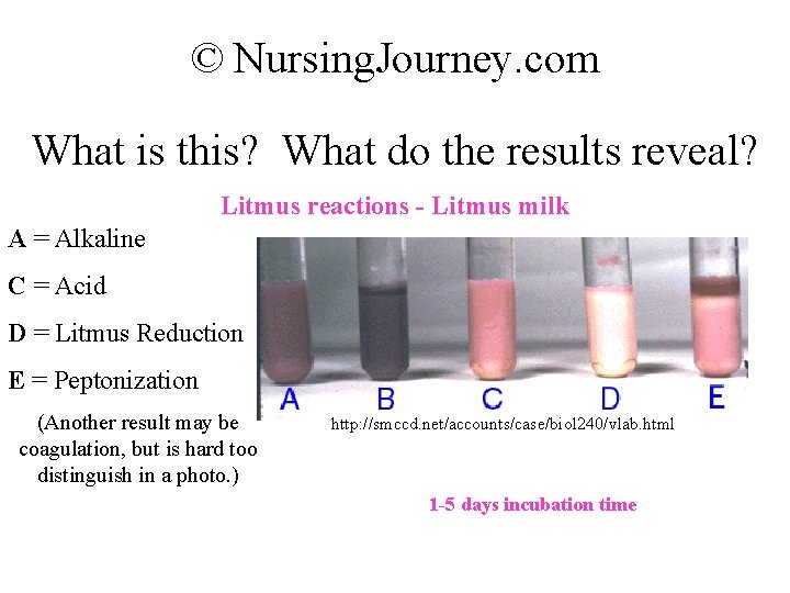 © Nursing. Journey. com What is this? What do the results reveal? Litmus reactions