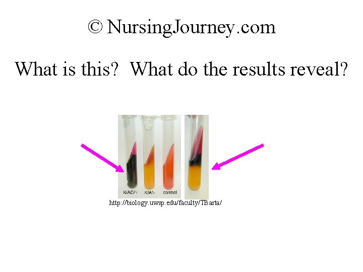 © Nursing. Journey. com What is this? What do the results reveal? http: //biology.