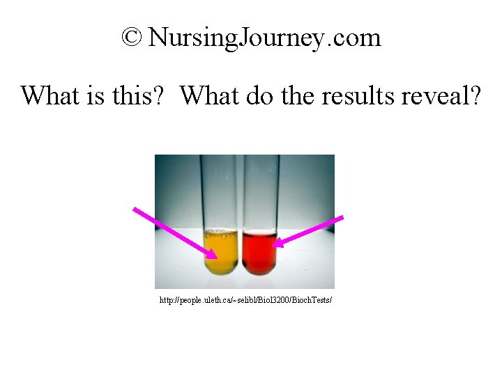 © Nursing. Journey. com What is this? What do the results reveal? http: //people.