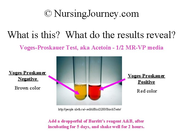 © Nursing. Journey. com What is this? What do the results reveal? Voges-Proskauer Test,