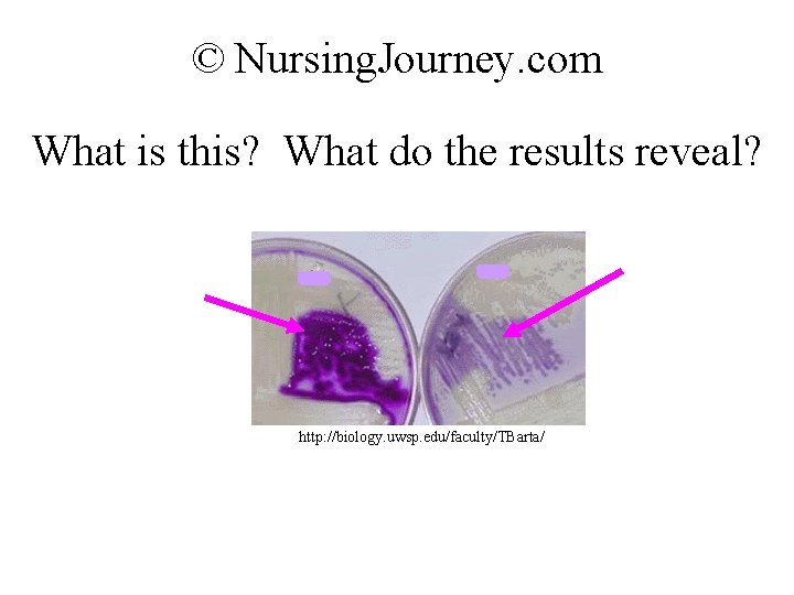 © Nursing. Journey. com What is this? What do the results reveal? http: //biology.