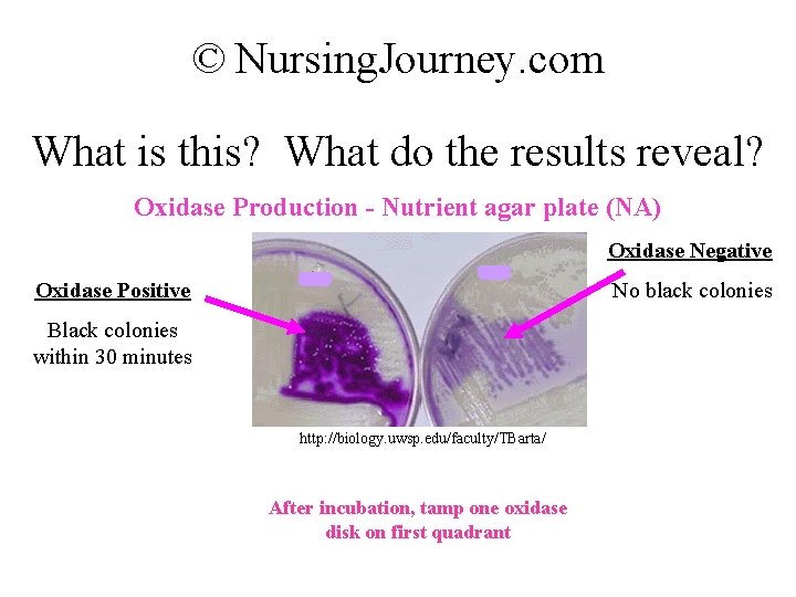© Nursing. Journey. com What is this? What do the results reveal? Oxidase Production