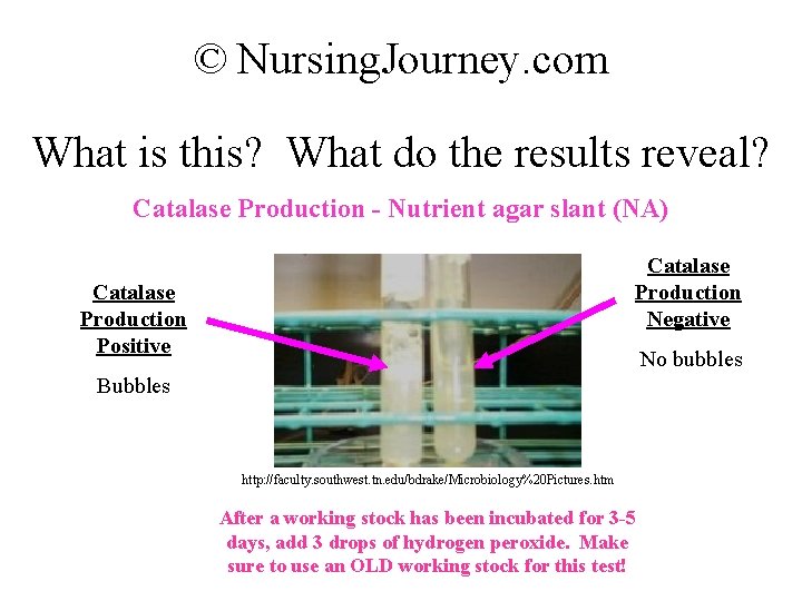 © Nursing. Journey. com What is this? What do the results reveal? Catalase Production