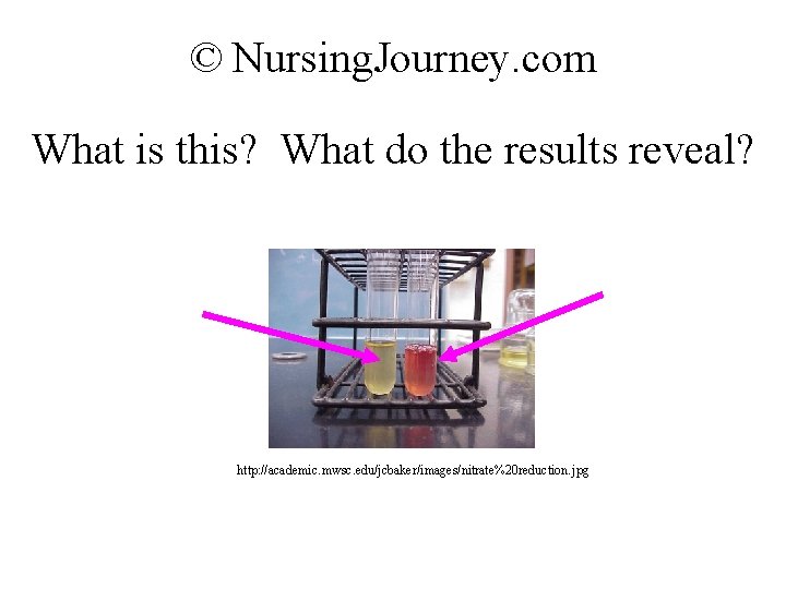 © Nursing. Journey. com What is this? What do the results reveal? http: //academic.
