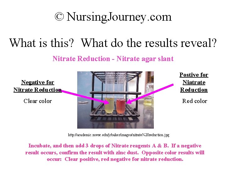© Nursing. Journey. com What is this? What do the results reveal? Nitrate Reduction