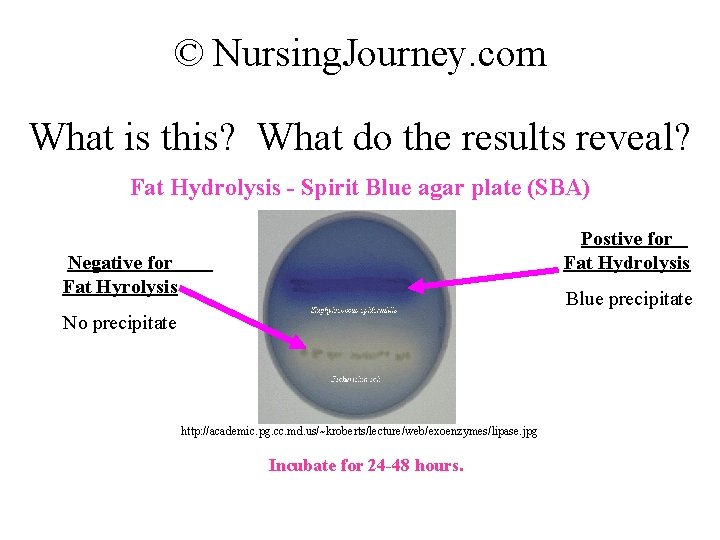 © Nursing. Journey. com What is this? What do the results reveal? Fat Hydrolysis