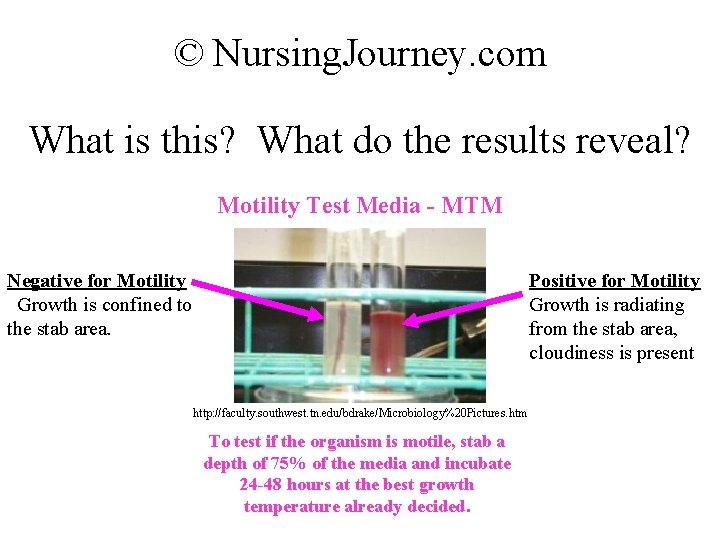 © Nursing. Journey. com What is this? What do the results reveal? Motility Test