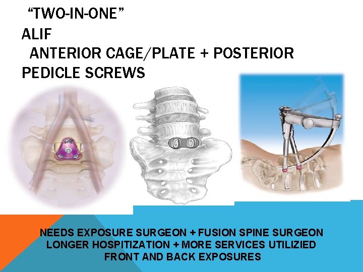 “TWO-IN-ONE” ALIF ANTERIOR CAGE/PLATE + POSTERIOR PEDICLE SCREWS NEEDS EXPOSURE SURGEON + FUSION SPINE