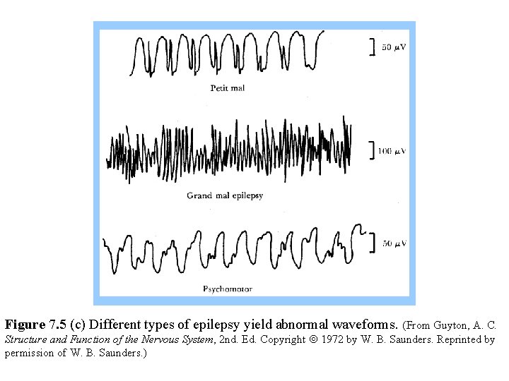 Figure 7. 5 (c) Different types of epilepsy yield abnormal waveforms. (From Guyton, A.
