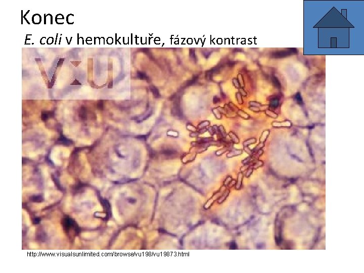 Konec E. coli v hemokultuře, fázový kontrast http: //www. visualsunlimited. com/browse/vu 19873. html 