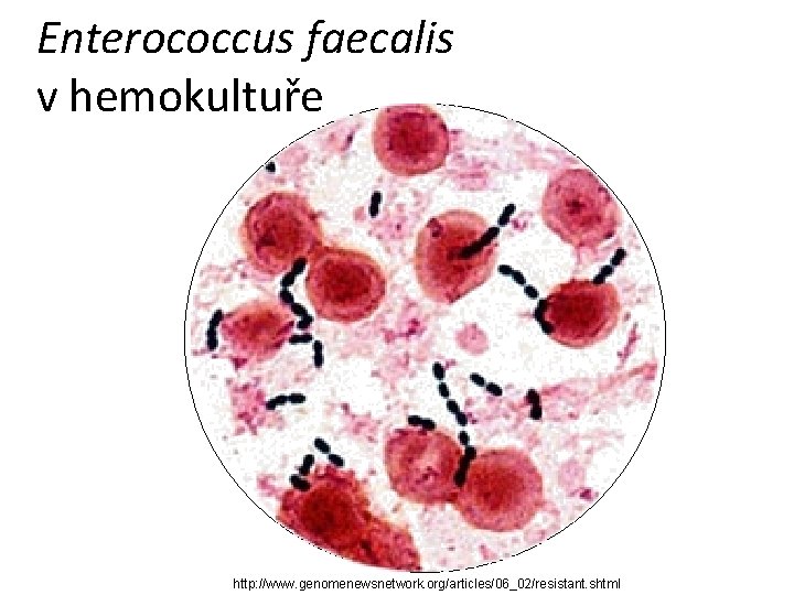 Enterococcus faecalis v hemokultuře http: //www. genomenewsnetwork. org/articles/06_02/resistant. shtml 