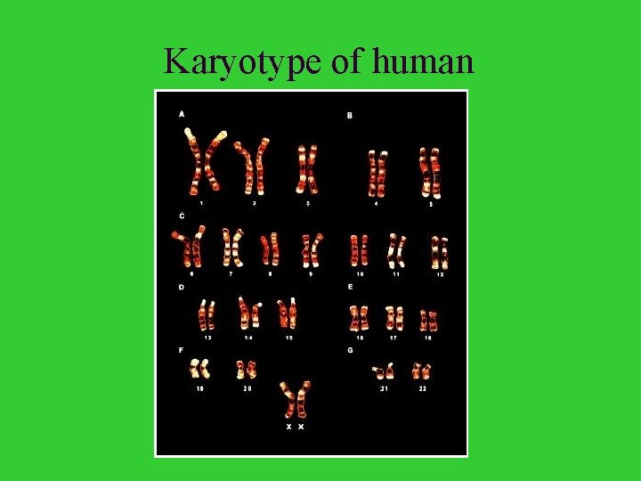 Karyotype of human 