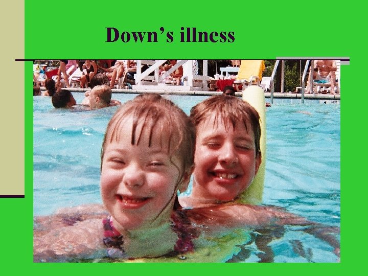 Down’s illness 