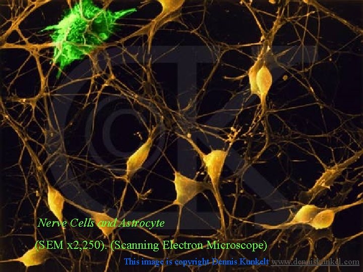 Nerve Cells and Astrocyte (SEM x 2, 250). (Scanning Electron Microscope) Matematikai és Informatikai