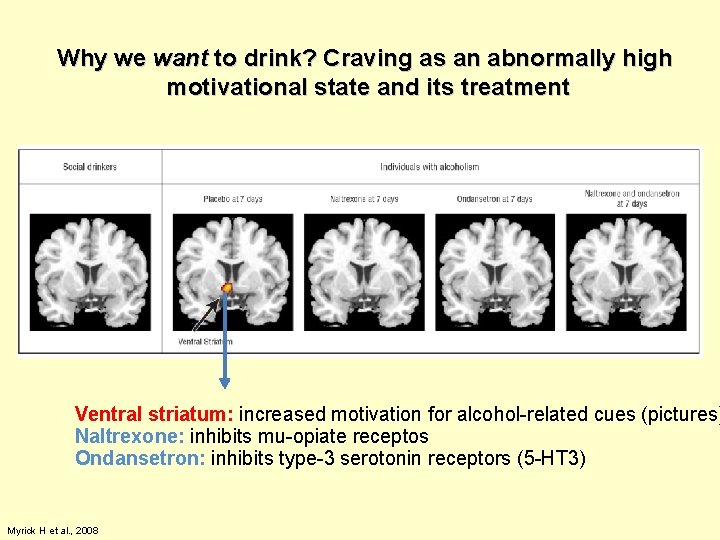 Why we want to drink? Craving as an abnormally high motivational state and its