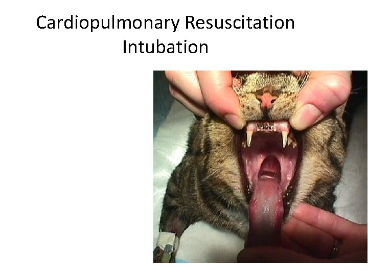 Cardiopulmonary Resuscitation Intubation 