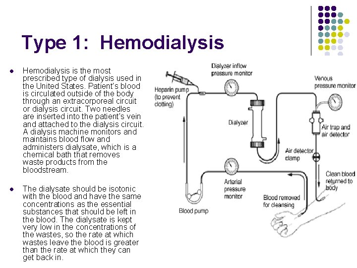 Type 1: Hemodialysis l Hemodialysis is the most prescribed type of dialysis used in