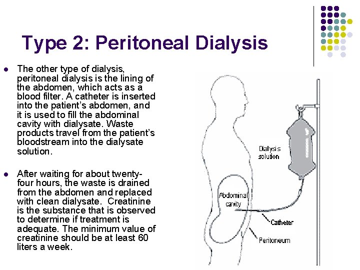 Type 2: Peritoneal Dialysis l The other type of dialysis, peritoneal dialysis is the